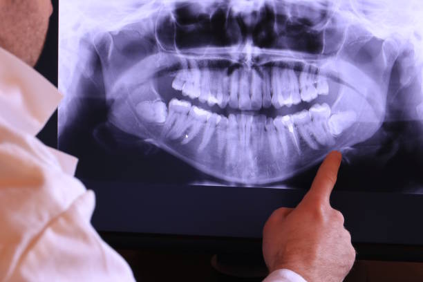 Best Urgent Care for Lost Fillings or Crowns in St Louis, MI