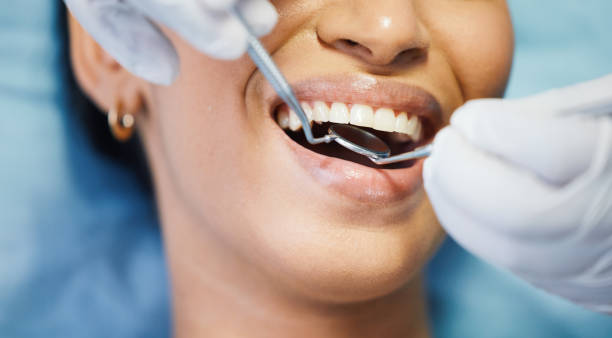 Best Emergency Treatment for Dental Infections or Abscesses in St Louis, MI