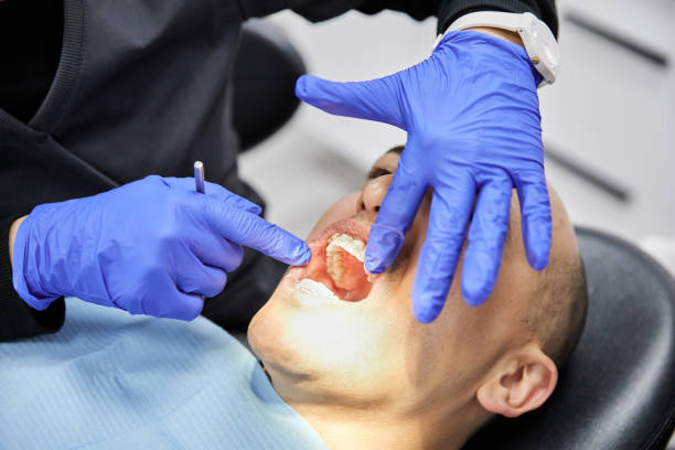 Best Emergency Gum Treatment in St Louis, MI